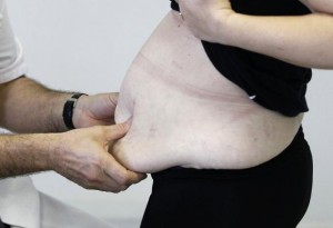 Surgeon Dr. Alexandre Lesage examines an obese patient in his office prior to surgery at the Saint Jean d'Angely Hospital, in Saint Jean d'Angley, France in this file photo taken January 24, 2013. REUTERS/Regis Duvignau/Files