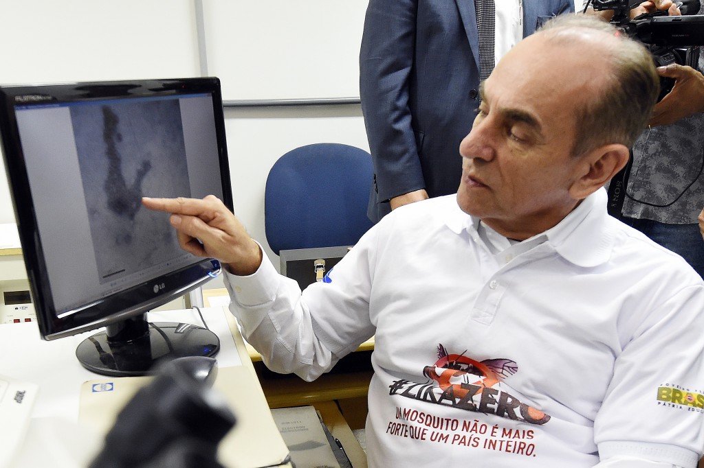 Brazilian Health Minister Marcelo Castro points to the image of the Zika virus on a computer during a visit to the Biological Sciences Institute at the University of Brasilia on February 19, 2016. Brazilian universities are carrying out research into the Zika virus due to a rise in the number of cases of microcephaly, which can be caused in unborn children when mothers are infected by the virus. AFP PHOTO/ EVARISTO SA / AFP PHOTO / EVARISTO SA