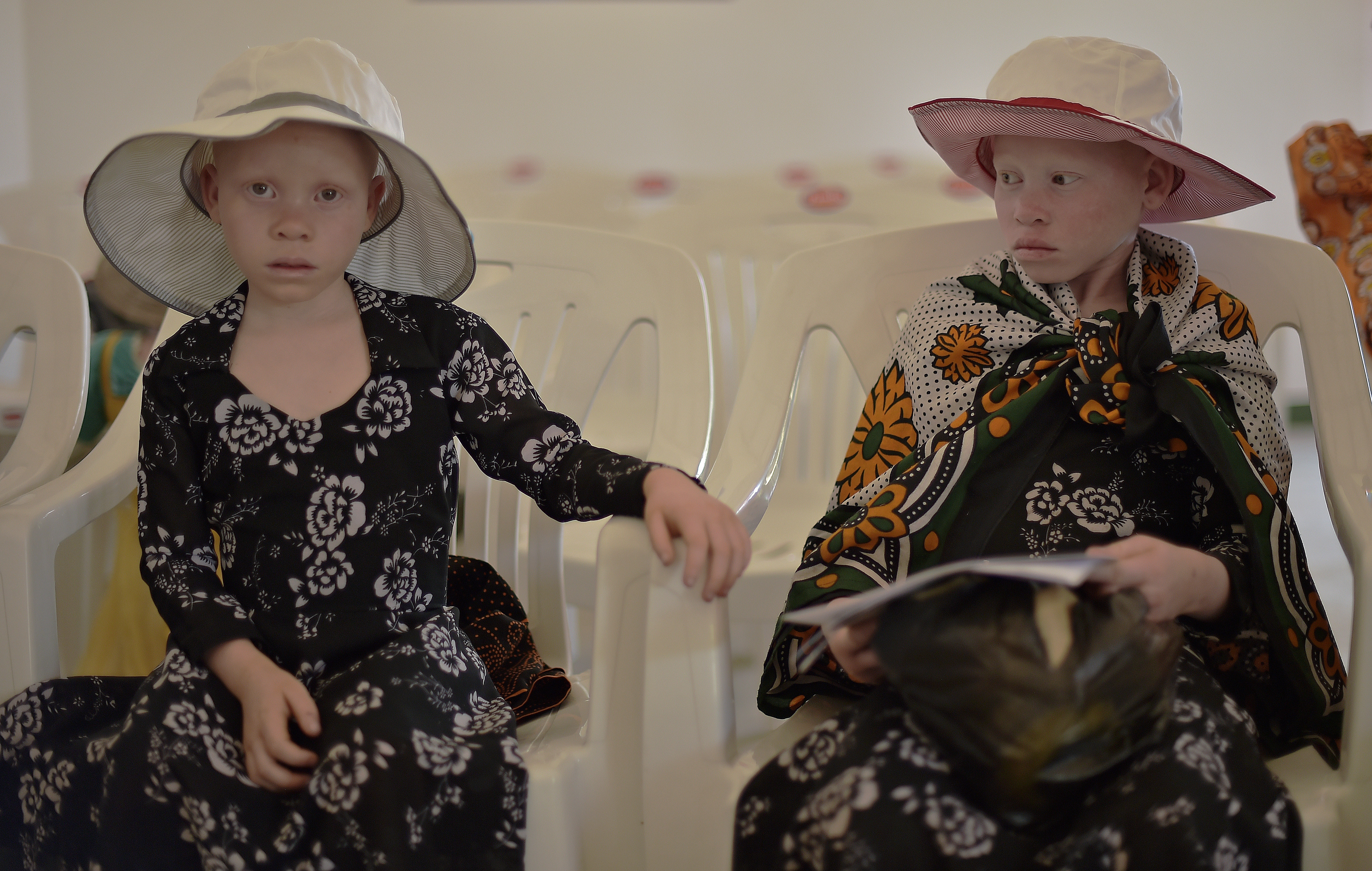 Albino girls sit as they wait at a clinic run by the Standing Voice NGO, on Ukerewe Island in Victoria lake during International Albinism Awareness day on June 13, 2016.  Albinism affects the development of human eyes so eye checks are a vital service needed by Albinos. Ukerewe island is home to many albinos. Many of the first albinos to live on the island were taken there and abandoned by their families as children or fled from violence they had faced on the mainland. Ukerewe island is now seen as a safer place for Albinos to live and integrate, as supersperstition has caused the practice of mutilation and killing of albinos by some witchdoctors for many years both in Tanzania and other African countries. / AFP PHOTO / CARL DE SOUZA