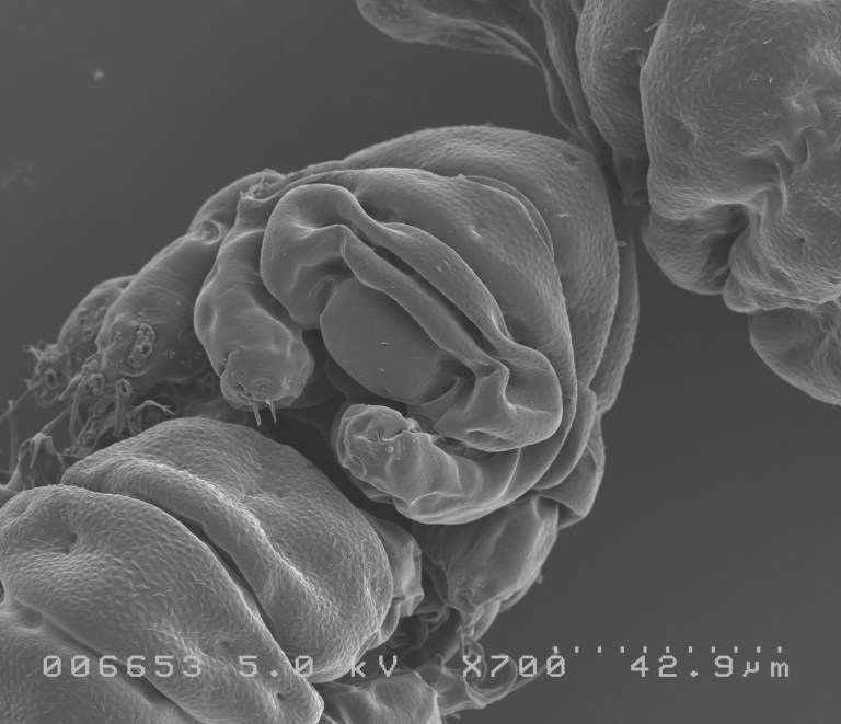 This handout picture released by Nature on September 20, 2016 shows a facial view of the tardigrade, Ramazzottius varieornatus. A protein unique to the miniscule water bear, probably the most indestructible animal on the planet, protected human DNA against X-rays in experiments, researchers stuned by their findings reported on September 19, 2016. Lab-grown human cells given the ability to create the newly discovered protein -- dubbed "Dsup" for "damage suppressor" -- showed only half as much decay as normal cells when blasted with deadly radiation. / AFP PHOTO / NATURE PUBLISHING GROUP / HO / RESTRICTED TO EDITORIAL USE - MANDATORY CREDIT "AFP PHOTO / NATURE / Tanaka S. / Sagara H. / Kunieda." - NO MARKETING NO ADVERTISING CAMPAIGNS - DISTRIBUTED AS A SERVICE TO CLIENTS