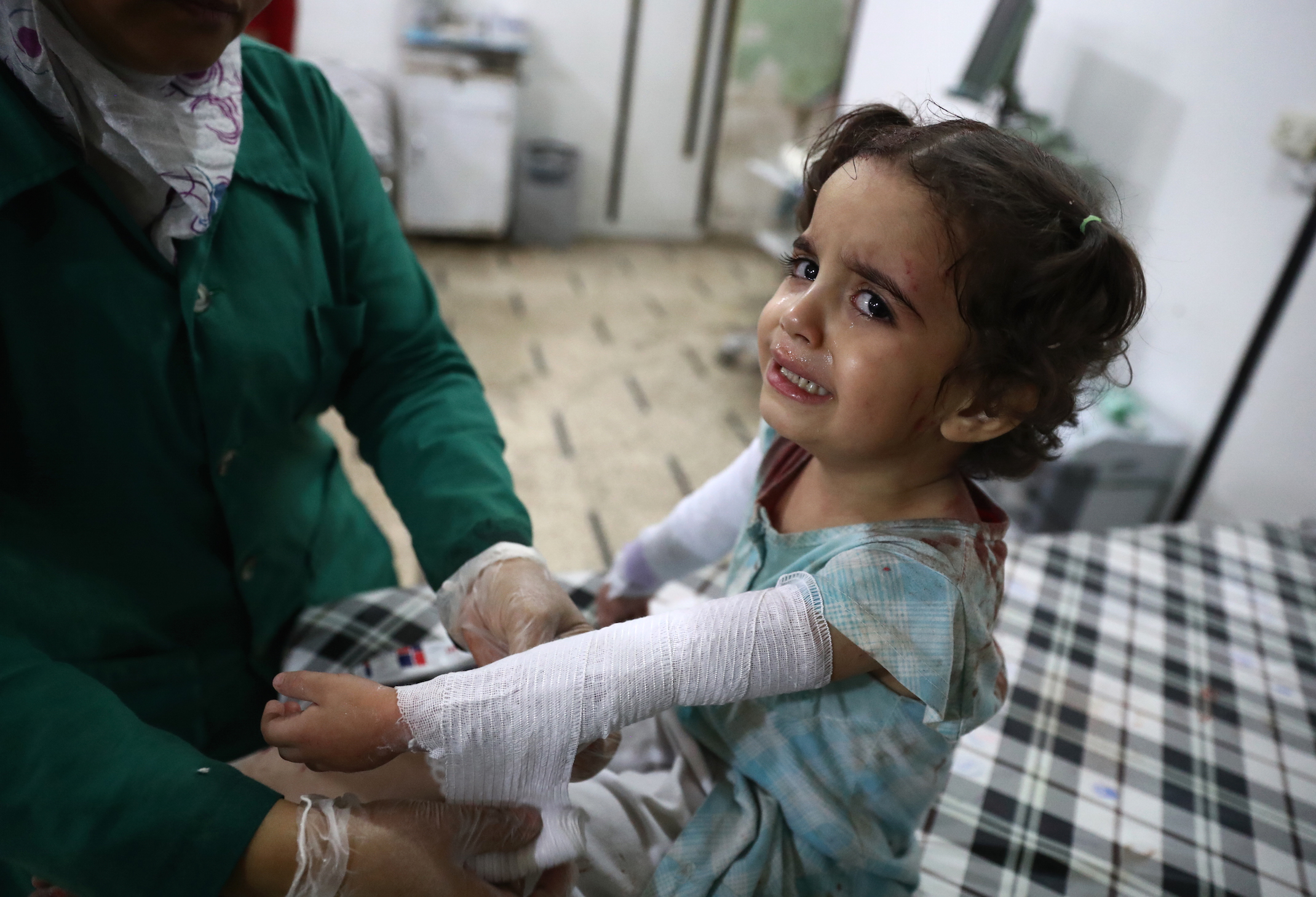 EDITORS NOTE: Graphic content / A Syria girl cries as she receives treatment at a make-shift hospital in the rebel-held town of Douma, east of the Syrian capital Damascus, following reported cluster bomb shelling on October 20, 2016. / AFP PHOTO / Abd Doumany