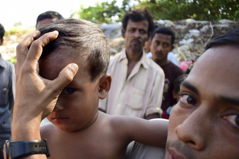 Rohingya refugee Mohammad Ayaz shows baton wound on his son Mohammad Osman's forehead at an unregistered refugee camp at Ukhiya in southern Cox's Bazar district on November 24, 2016. / AFP PHOTO / SAM JAHAN