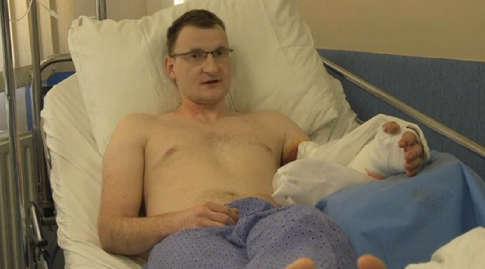 Polish doctors succeed in transplanting hand from dead man to 32 year-old man born without a hand. (Photo courtesy to Reuters video)