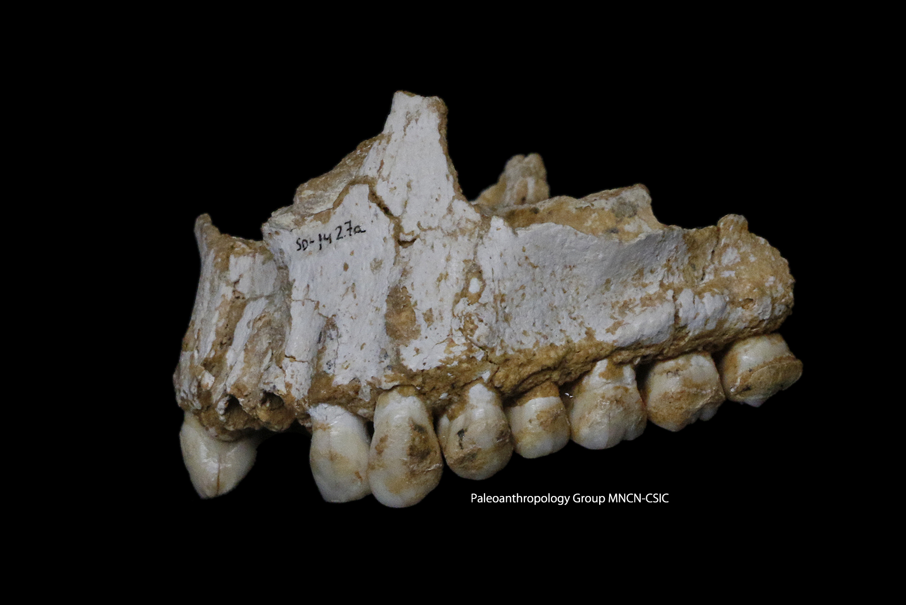 A handout photo released on March 7, 2017 by Paleoanthropology Group MNCN-CSIC shows the upper jaw of Neanderthal El Sidron 1, found in what is today Spain, with a dental calculus deposit visible on the rear molar (right). Nearly 50,000 years before the invention of penicillin, this young Neanderthal tormented by a dental abscess ate greenery containing a natural antibiotic and pain killer, analysis of his teeth revealed on March 8, 2017. The male, who lived in El Sidron in what is now Spain, ate an antibiotic fungus called Penicillium and chewed on bits of poplar tree containing salicylic acid -- the active ingredient of modern-day aspirin, researchers said. / AFP PHOTO / Paleoanthropology Group MNCN-CSIC / Handout / RESTRICTED TO EDITORIAL USE - MANDATORY CREDIT "AFP PHOTO / Paleoanthropology Group MNCN-CSIC " - NO MARKETING NO ADVERTISING CAMPAIGNS - DISTRIBUTED AS A SERVICE TO CLIENTS