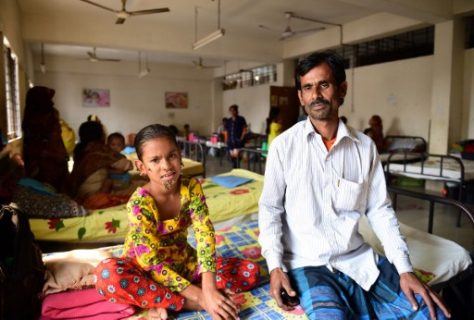(FILES) This file photograph taken on January 30, 2017, shows ten year-old Bangladeshi patient Sahana Khatun (L) and her father Mohammad Shahjahan as they pose for a photograph at The Dhaka Medical College and Hospital in Dhaka. A young Bangladeshi girl diagnosed with a rare condition known as "tree man syndrome" has left hospital, her father told AFP on March 27, 2017, saying that he feared she would never be cured. Surgeons operated on Sahana Khatun last month and removed some of the bark-like growths she has developed from the extremely rare condition of epidermodysplasia verruciformisa. / AFP PHOTO / STR