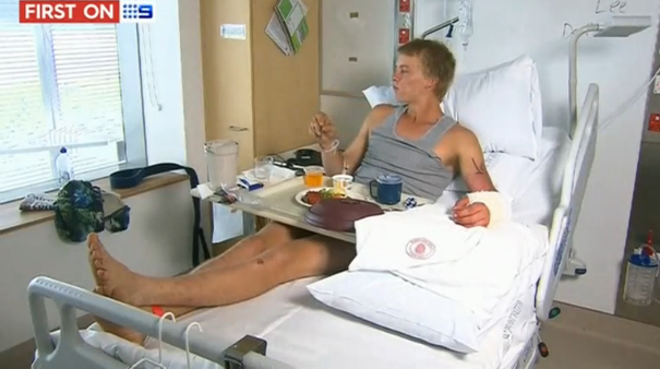 Man survives crocodile attack in Australia's northern Queensland after jumping into water to impress a British backpacker he had a crush on. (Photo grabbed from Reuters video)